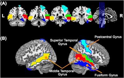 Abnormal Cortico-Cerebellar Functional Connectivity in Autism Spectrum Disorder